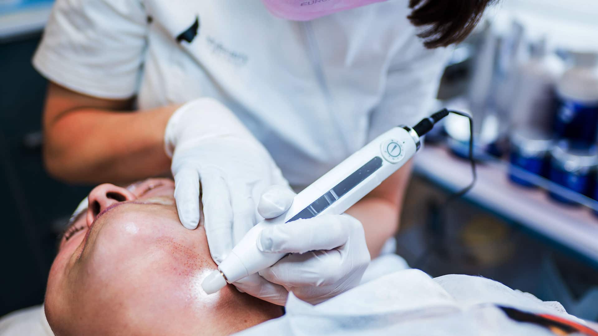 Manlig patient under en behandling med Plasma pen